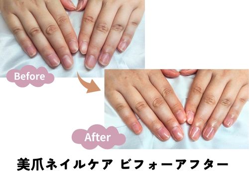 ネイルケアのビフォーアフター